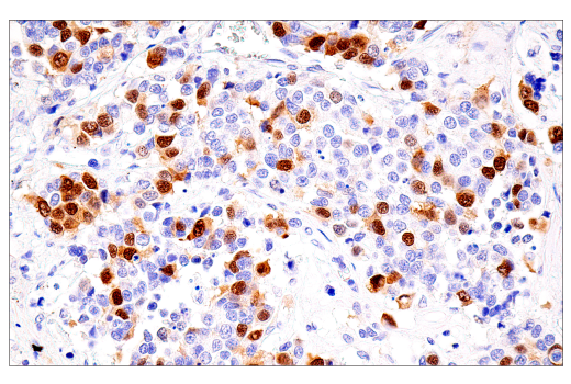 Immunohistochemistry Image 5: Cyclin A2 (E6D1J) XP<sup>®</sup> Rabbit mAb