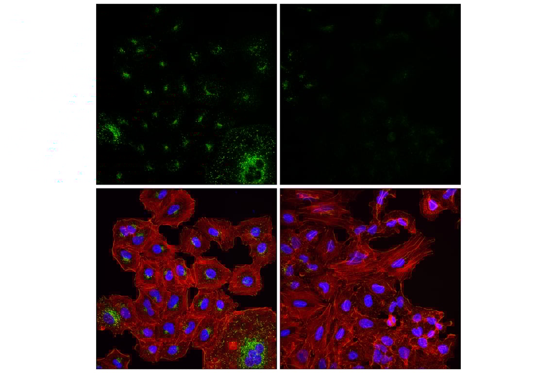 Immunofluorescence Image 2: APP (E3F3P) Rabbit mAb