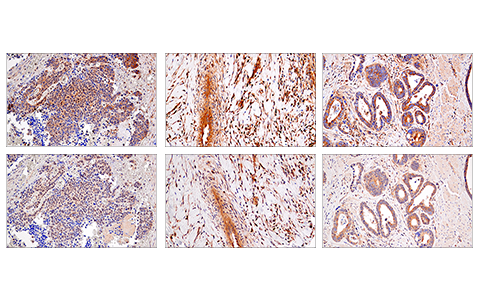 Immunohistochemistry Image 5: RIP (E8S7U) XP<sup>®</sup> Rabbit mAb