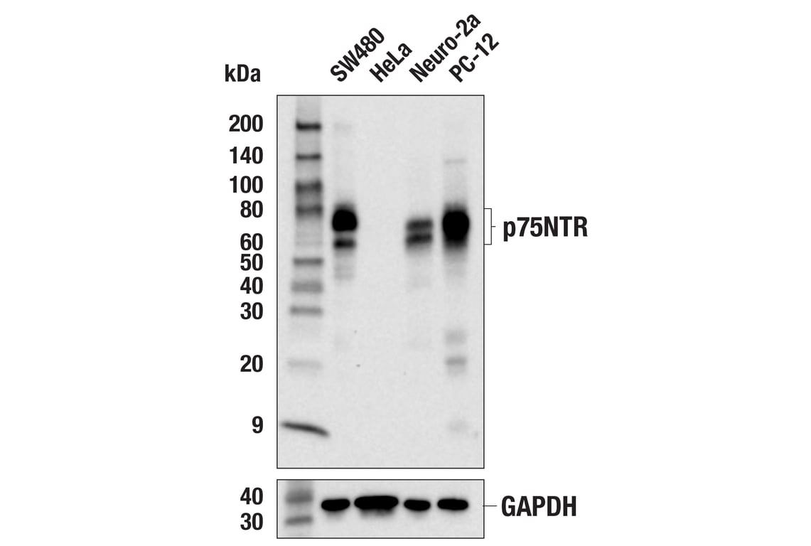 Western Blotting Image 1: p75NTR (E7I3M) Rabbit mAb