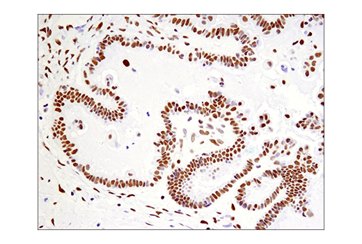 Immunohistochemistry Image 7: Phospho-ATF-2 (Thr71)/ATF-7 (Thr53) (E4A5G) XP<sup>®</sup> Rabbit mAb