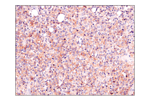 Immunohistochemistry Image 3: ASCT2 (D7C12) Rabbit mAb (BSA and Azide Free)