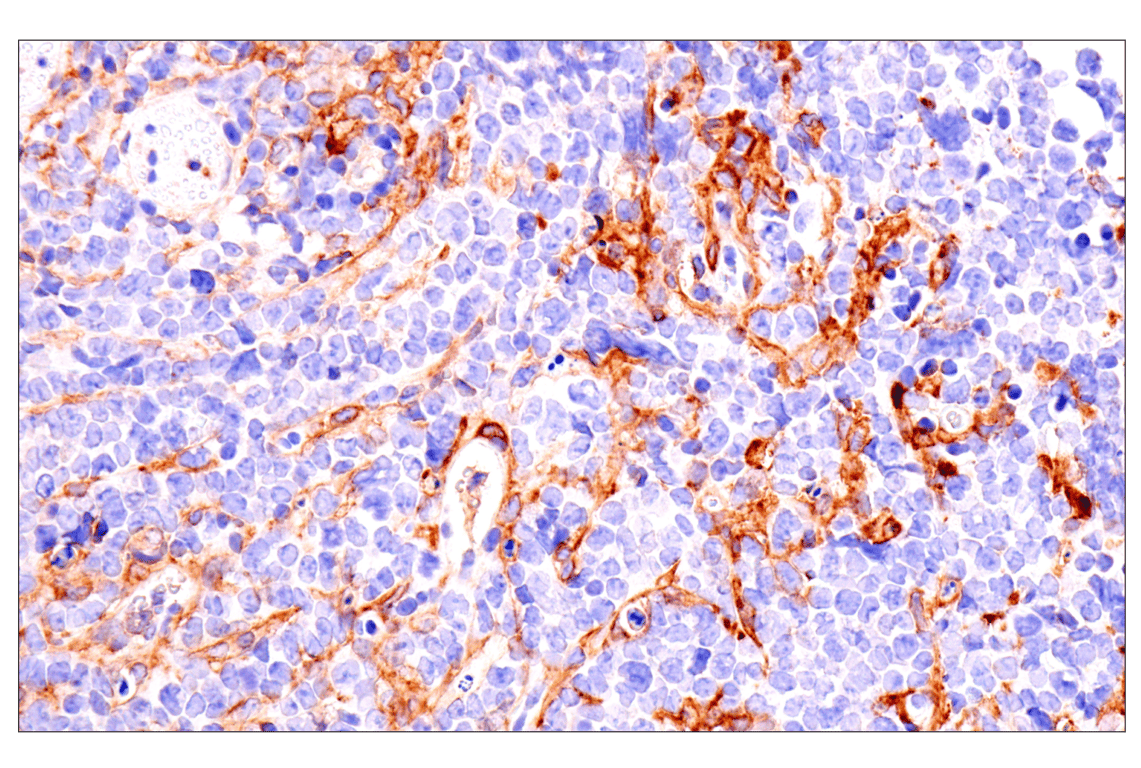 Immunohistochemistry Image 1: Axl (E3Z2H) Rabbit mAb (BSA and Azide Free)