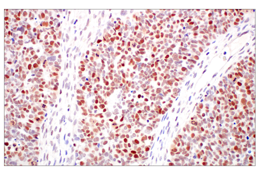 Immunohistochemistry Image 6: DNMT1 (D63A6) XP<sup>®</sup> Rabbit mAb (BSA and Azide Free)