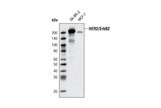 Western Blotting Image 1: HER2/ErbB2 (D8F12) XP® Rabbit mAb