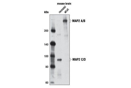 Western Blotting Image 1: MAP2 (D5G1) XP® Rabbit mAb