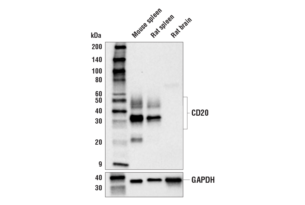 Western Blotting Image 3: CD20 (E3N7O) XP<sup>®</sup> Rabbit mAb