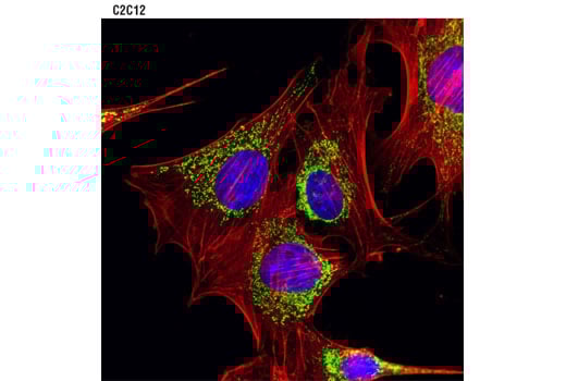 undefined Image 37: Cell Fractionation Antibody Sampler Kit