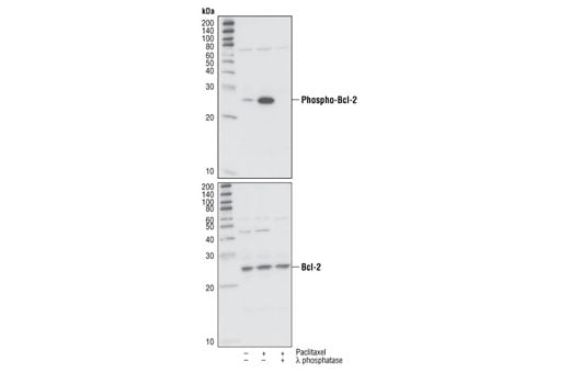 Western Blotting Image 1: Phospho-Bcl-2 (Ser70) (5H2) Rabbit mAb