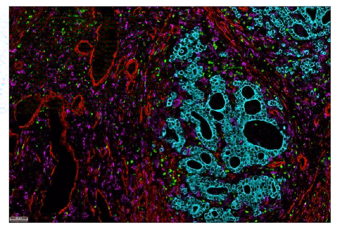 Immunohistochemistry Image 8: α-Smooth Muscle Actin (D4K9N) & CO-0024-488 SignalStar<sup>™</sup> Oligo-Antibody Pair