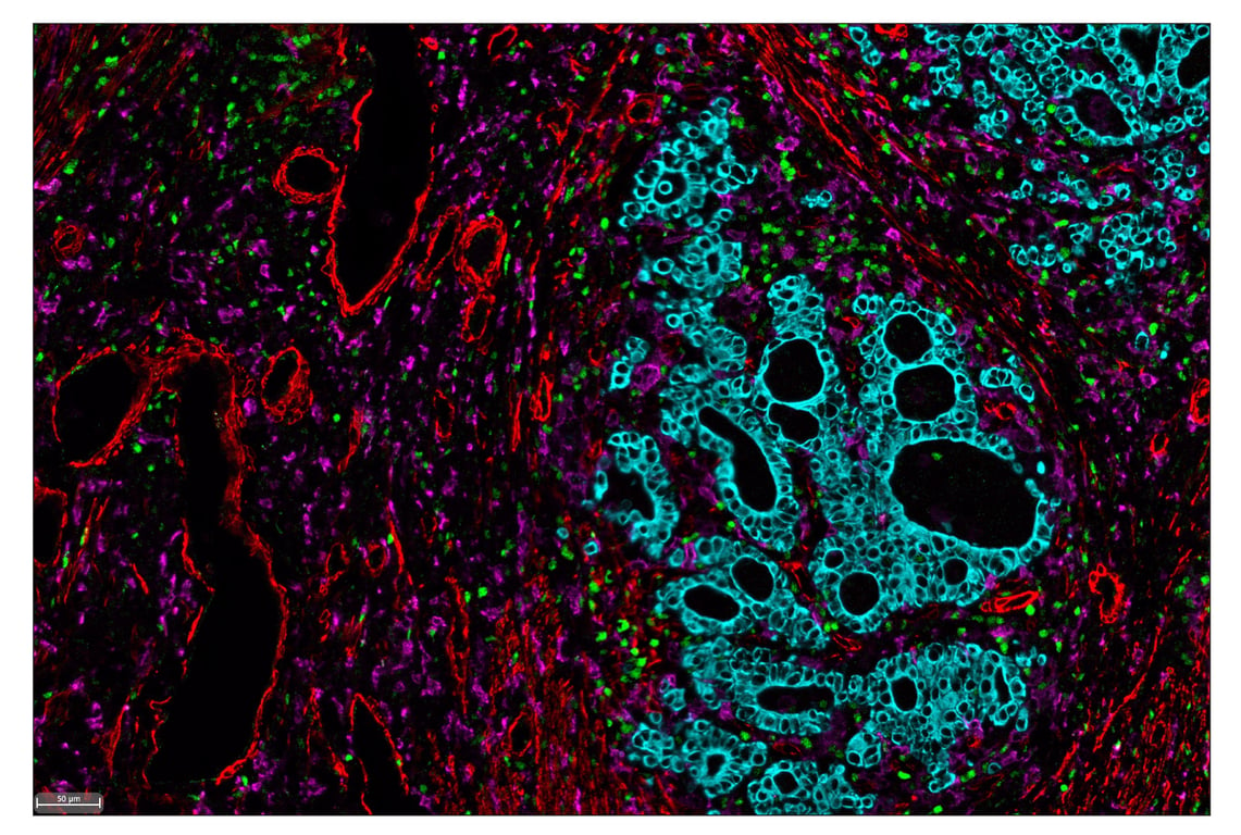 Immunohistochemistry Image 8: α-Smooth Muscle Actin (D4K9N) & CO-0024-594 SignalStar<sup>™</sup> Oligo-Antibody Pair