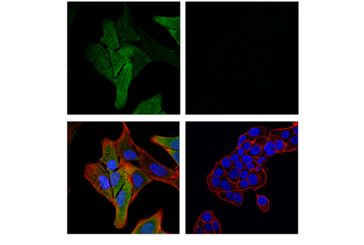 Immunofluorescence Image 1: MAGE-A4 (E7O1U) XP<sup>®</sup> Rabbit mAb (BSA and Azide Free)