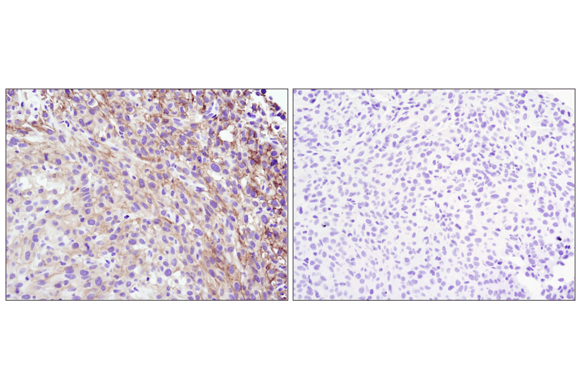 Immunohistochemistry Image 6: Phospho-Akt (Ser473) (D9E) XP<sup>®</sup> Rabbit mAb (BSA and Azide Free)