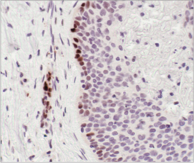 使用 CD19 (Intracellular Domain) (D4V4B) XP<sup>®</sup> Rabbit mAb 对石蜡包埋的人扁桃体细胞进行免疫组织化学分析。
