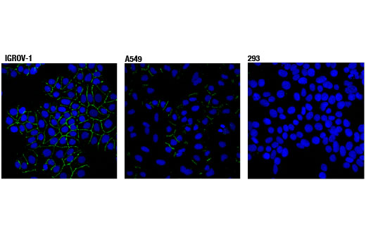 undefined Image 12: Epithelial-Mesenchymal Transition (EMT) IF Antibody Sampler Kit