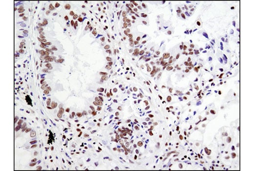 Immunohistochemistry Image 4: RBPSUH (D10A4) XP<sup>®</sup> Rabbit mAb