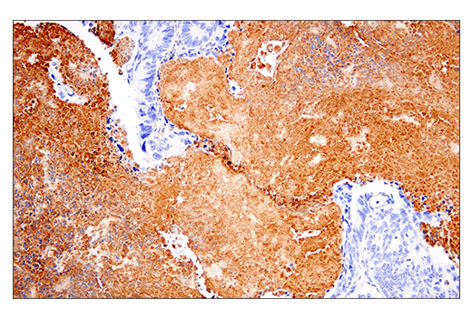 undefined Image 36: Extracellular Matrix Dynamics Antibody Sampler Kit
