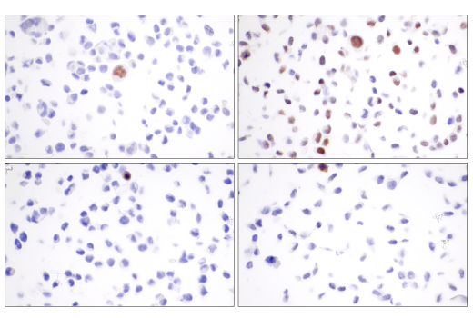 undefined Image 7: PhosphoPlus<sup>®</sup> Chk2 (Thr68) Antibody Duet