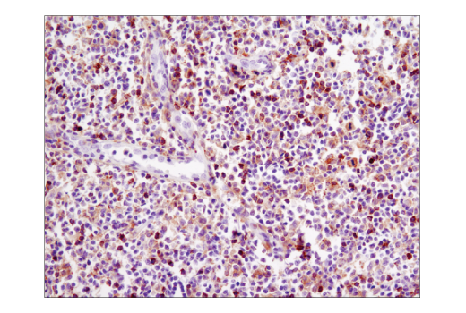 Immunohistochemistry Image 1: Btk (D3H5) Rabbit mAb (BSA and Azide Free)