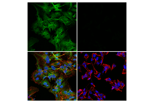 Immunofluorescence Image 1: Phospho-Atg4B (Ser383) (E3I8M) Rabbit mAb