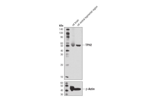 Western Blotting Image 2: TPH2 (D3E5I) XP<sup>®</sup> Rabbit mAb