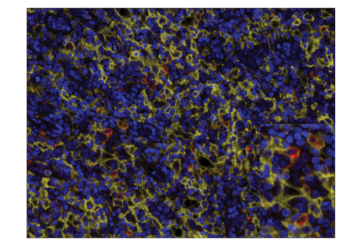 Immunohistochemistry Image 4: XCR1 (D2F8T) Rabbit mAb (BSA and Azide Free)
