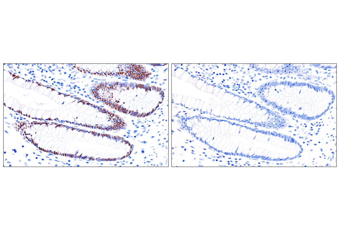Immunohistochemistry Image 23: GATA-6 (D61E4) XP<sup>®</sup> Rabbit mAb (BSA and Azide Free)
