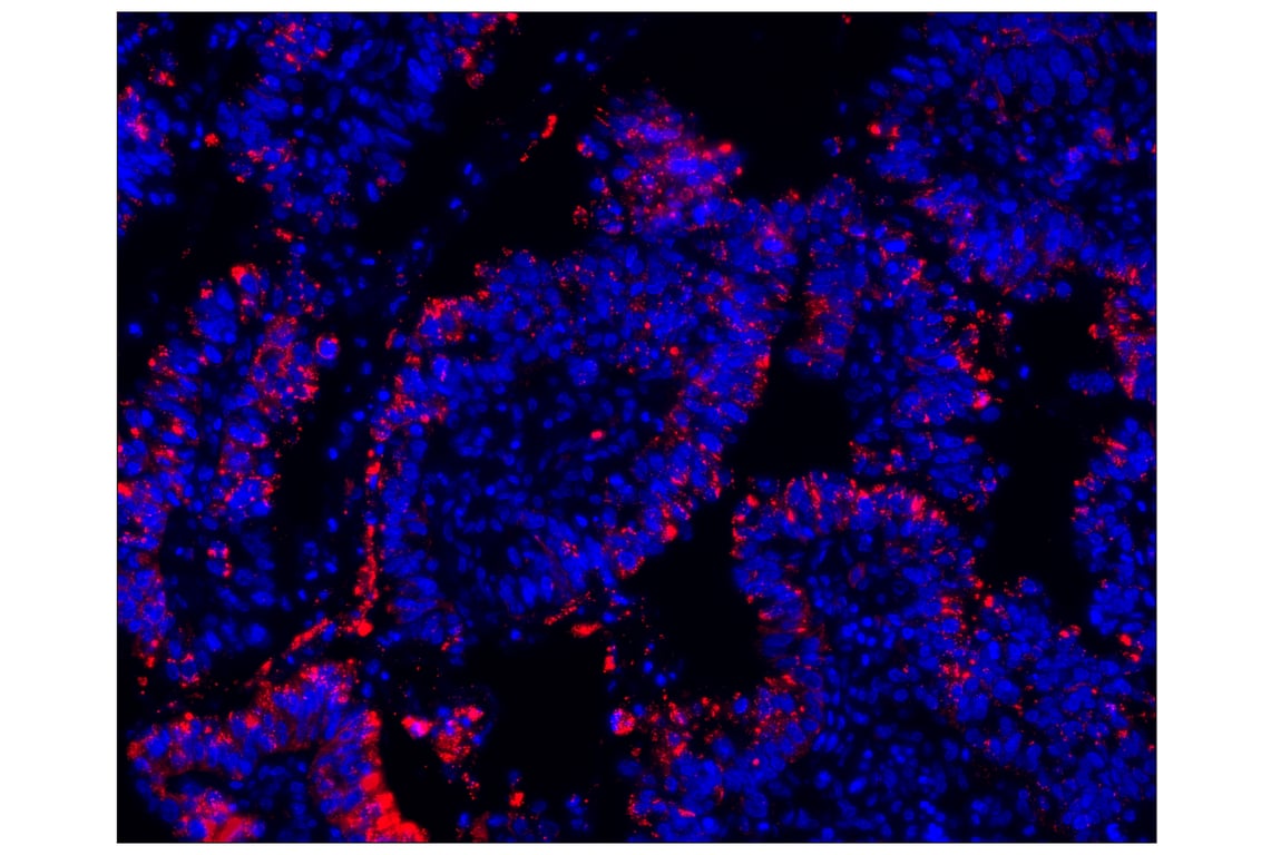 Immunohistochemistry Image 1: HLA-DRA (E9R2Q) XP® Rabbit mAb (Alexa Fluor® 647 Conjugate)