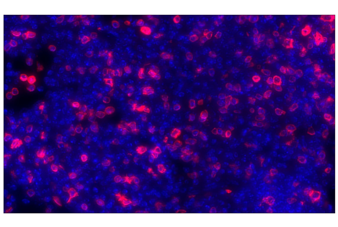 Immunohistochemistry Image 1: CD3ε (E4T1B) XP<sup>®</sup> Rabbit mAb (Alexa Fluor<sup>®</sup> 647 Conjugate)