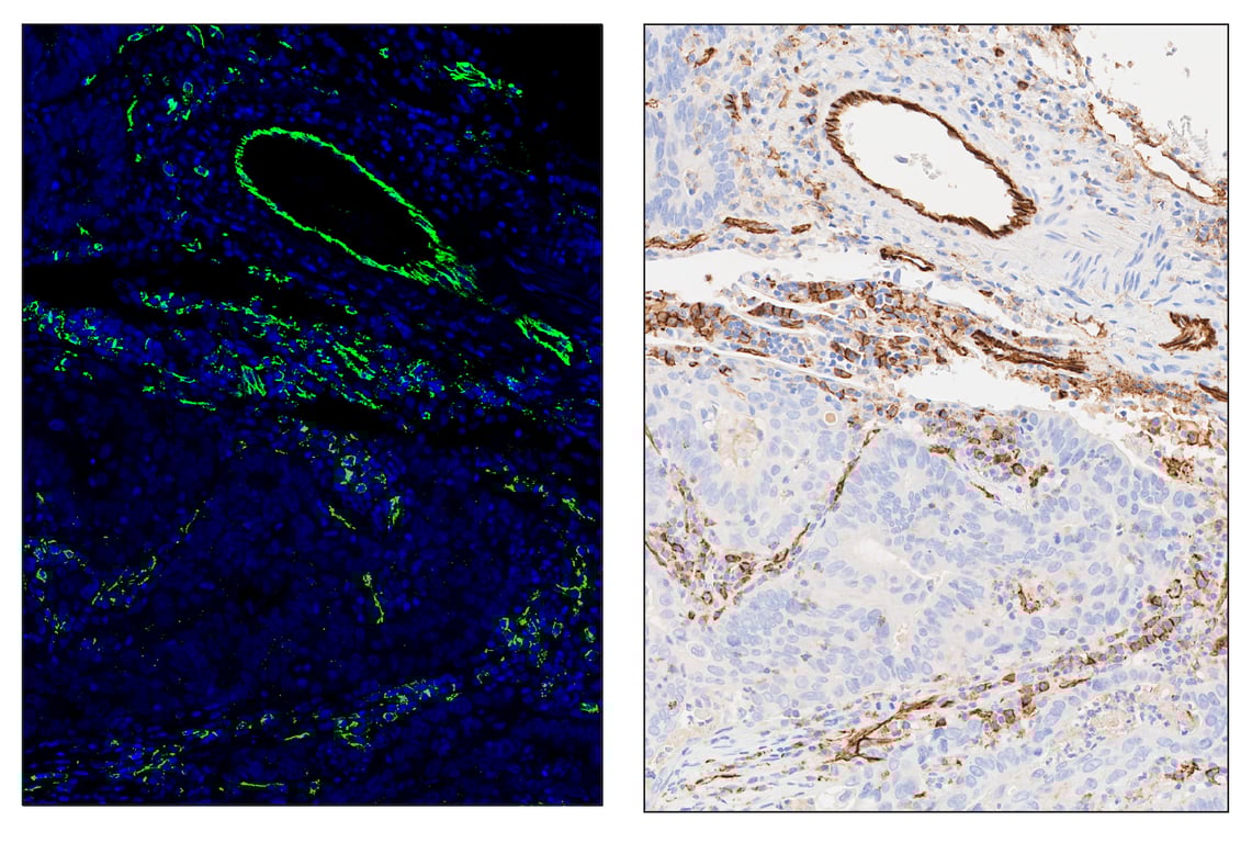 Immunohistochemistry Image 6: CD31 (PECAM-1) (89C2) & CO-0028-750 SignalStar<sup>™</sup> Oligo-Antibody Pair