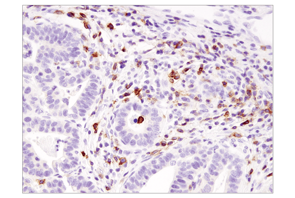 Immunohistochemistry Image 3: ICOS (D1K2T<sup>™</sup>) Rabbit mAb (BSA and Azide Free)