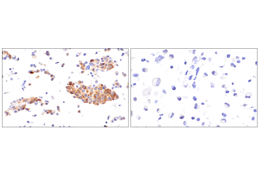 Immunohistochemistry Image 6: Fibrinogen gamma chain (E1U3Z) XP<sup>®</sup> Rabbit mAb (BSA and Azide Free)