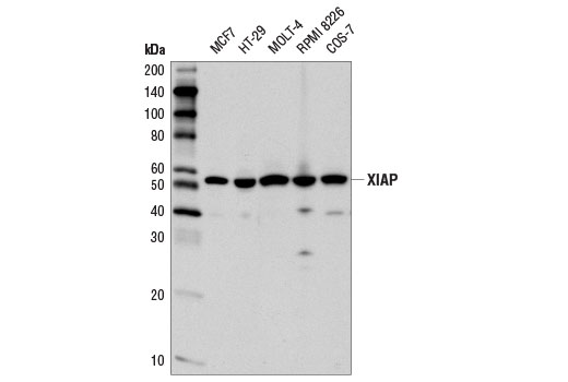 Western Blotting Image 1: XIAP (D2Z8W) Rabbit mAb
