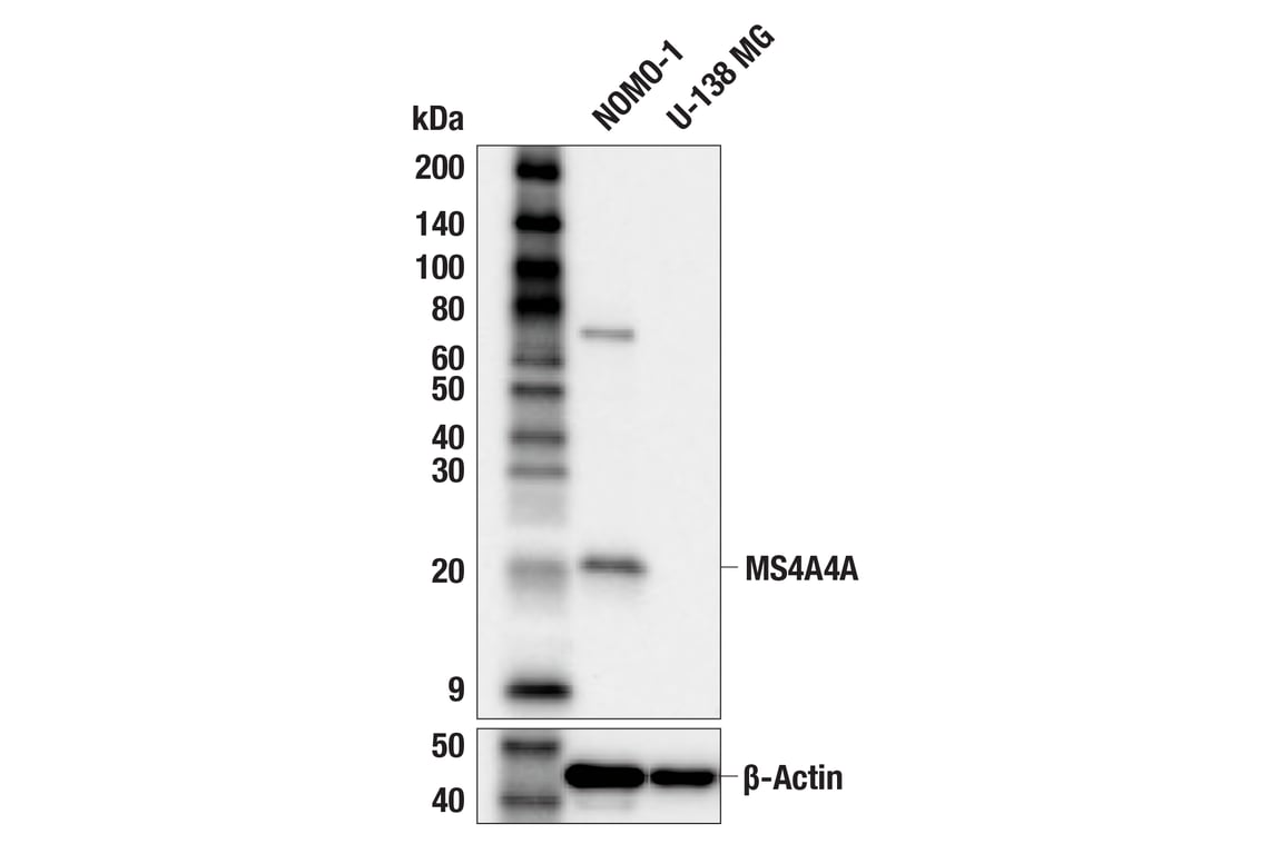 Western Blotting Image 1: MS4A4A (F2E6F) Rabbit mAb