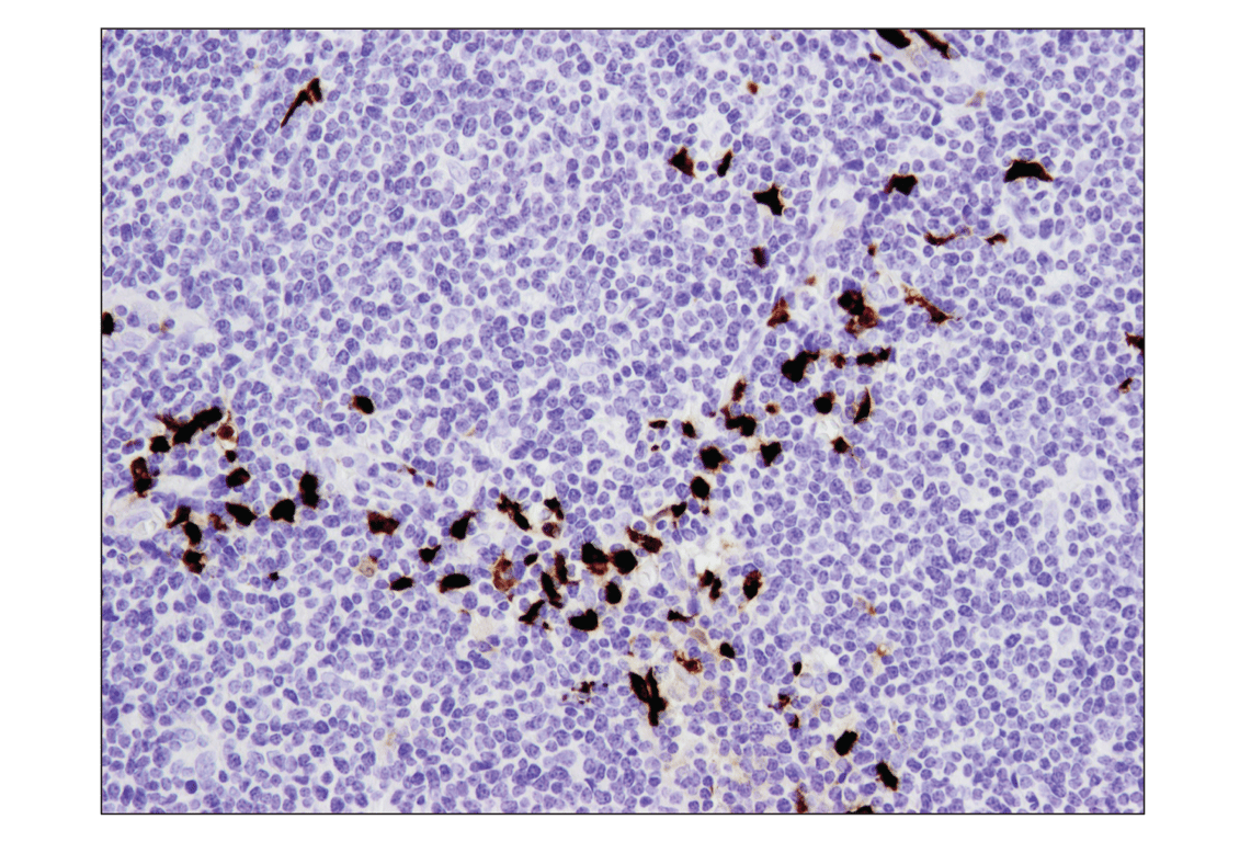 Immunohistochemistry Image 3: S100A9 (D5O6O) Rabbit mAb (BSA and Azide Free)