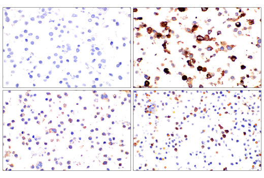undefined Image 33: Human Exhausted CD8<sup>+</sup> T Cell IHC Antibody Sampler Kit