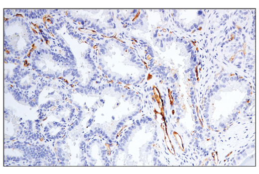 Immunohistochemistry Image 1: CD54/ICAM-1 (E3Q9N) XP<sup>®</sup> Rabbit mAb (BSA and Azide Free)