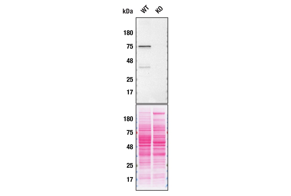 Western Blotting Image 2: TGM2 (D11A6) XP<sup>®</sup> Rabbit mAb