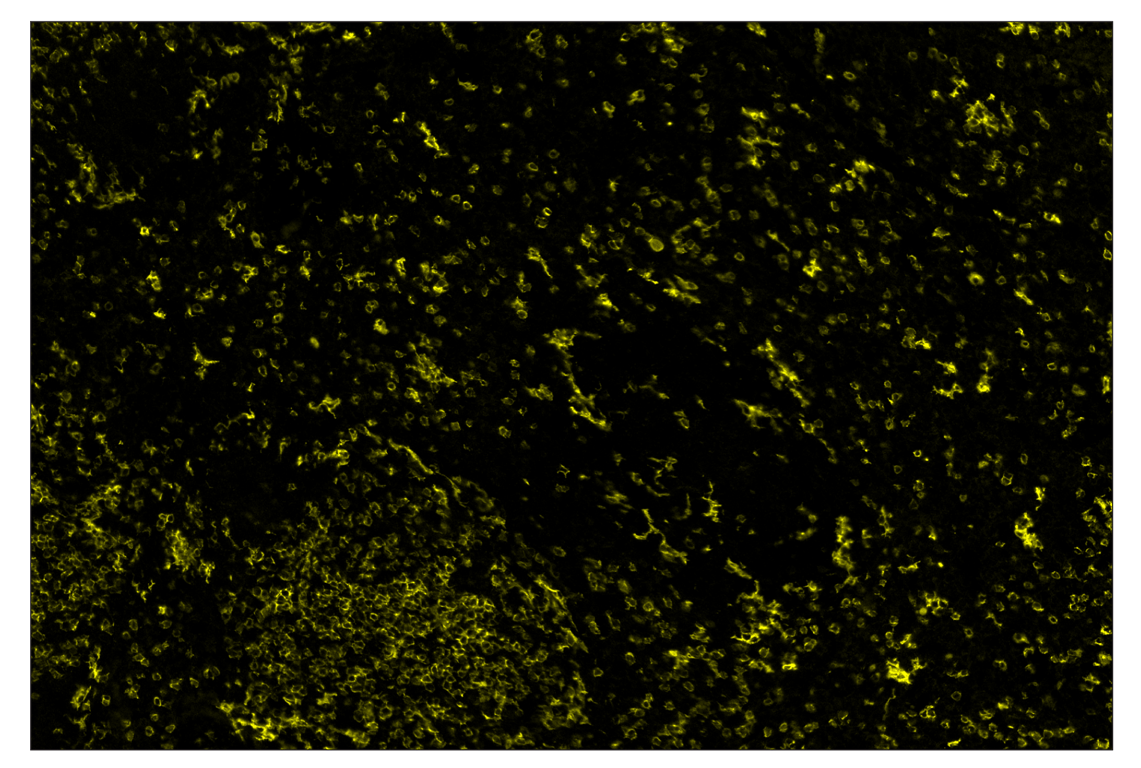 Immunohistochemistry Image 3: CD8α (D4W2Z) & CO-0040-488 SignalStar<sup>™</sup> Oligo-Antibody Pair