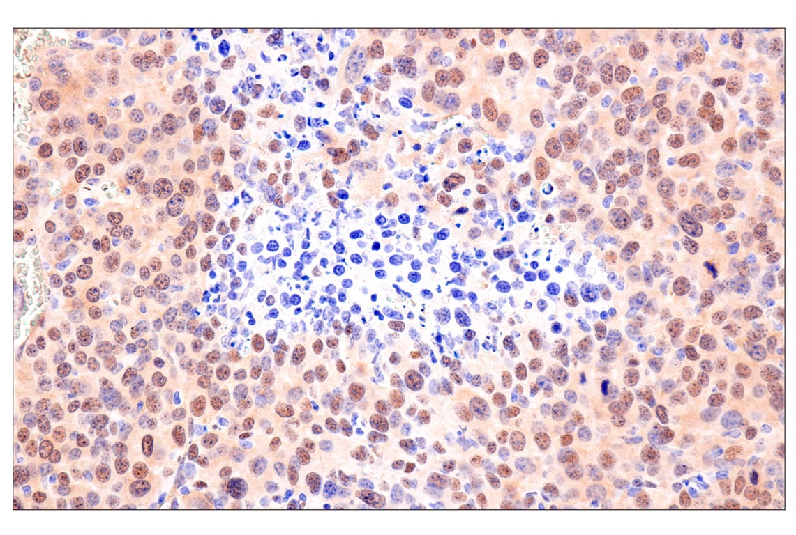 Immunohistochemistry Image 9: Phospho-YAP (Ser61) (E4Q8S) Rabbit mAb