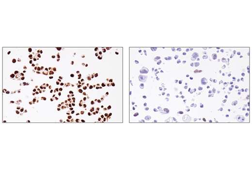 Immunohistochemistry Image 5: ADAR1 (E6X9R) XP<sup>®</sup> Rabbit mAb