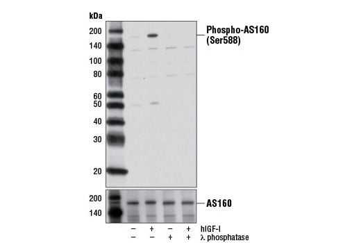 Western Blotting Image 1: Phospho-AS160 (Ser588) (D8E4) Rabbit mAb