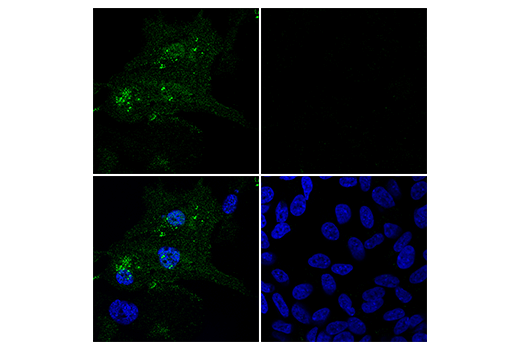 Immunofluorescence Image 1: Iba1/AIF-1 (E4O4W) XP<sup>®</sup> Rabbit mAb (Alexa Fluor<sup>®</sup> 488 Conjugate)