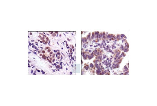 Immunohistochemistry Image 1: Stat3 (124H6) Mouse mAb