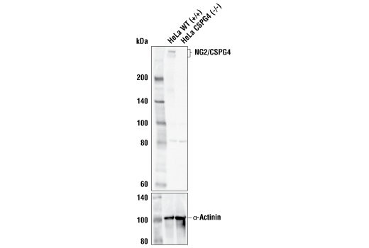 Western Blotting Image 1: NG2/CSPG4 (E3B3G) XP<sup>®</sup> Rabbit mAb (BSA and Azide Free)