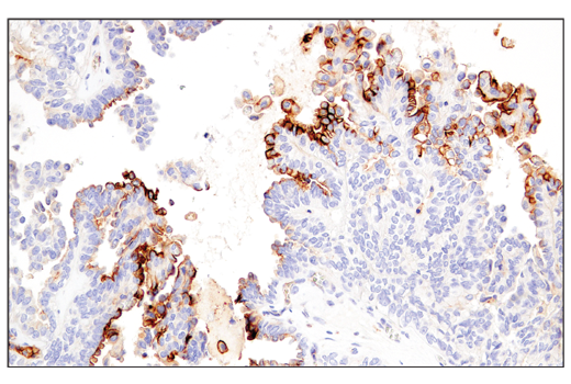 Immunohistochemistry Image 2: CD54/ICAM-1 (E3Q9N) XP<sup>®</sup> Rabbit mAb (BSA and Azide Free)