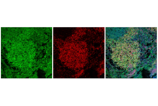 Immunofluorescence Image 1: p70 S6 Kinase (E8K6T) XP<sup>®</sup> Rabbit mAb