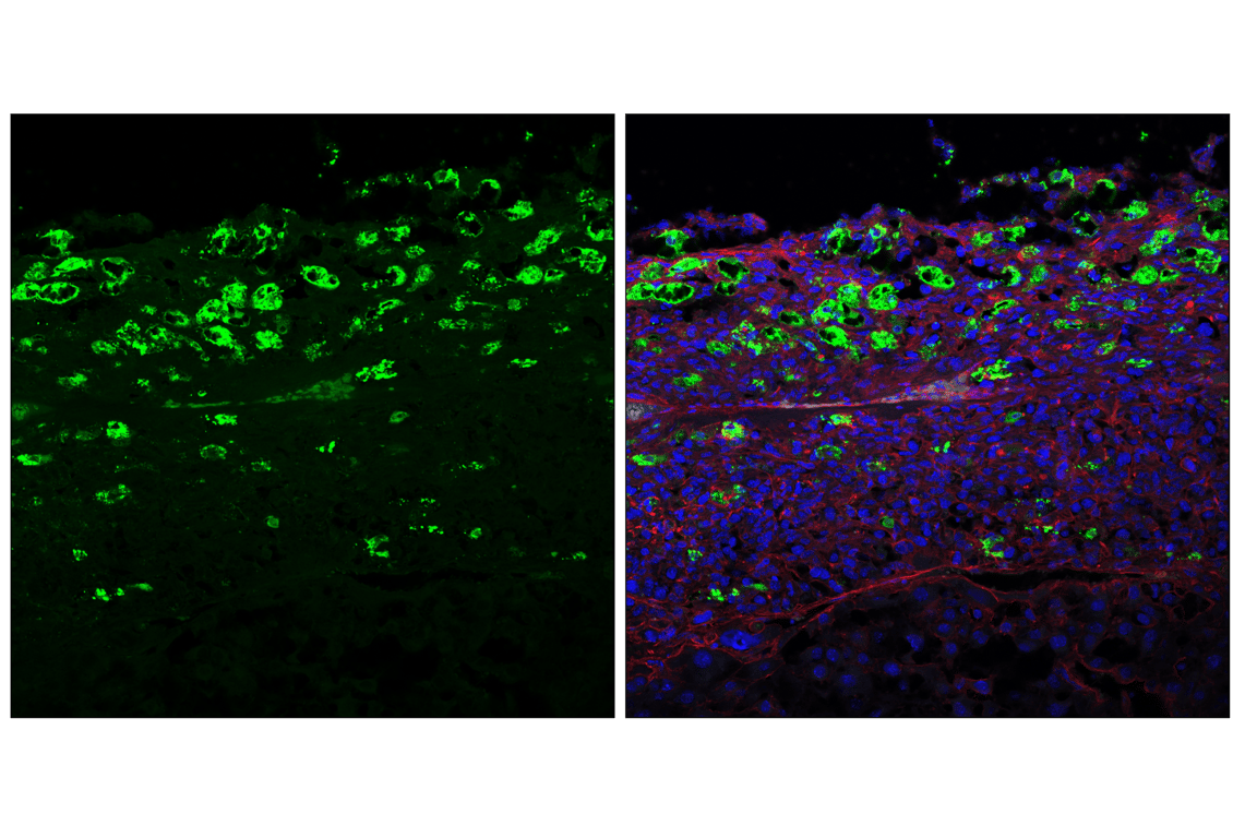 Immunofluorescence Image 1: Granzyme F (E2U7L) Rabbit mAb (BSA and Azide Free)