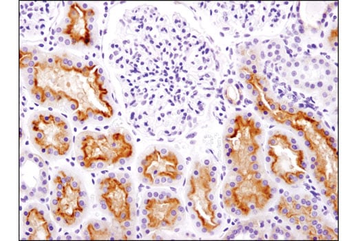 Immunohistochemistry Image 1: MDR1/ABCB1 (E1Y7S) Rabbit mAb