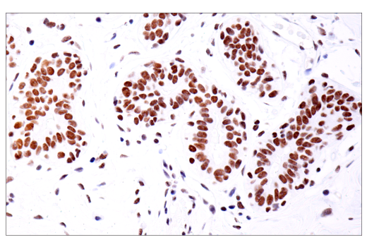 undefined Image 35: BAF Complex IHC Antibody Sampler Kit